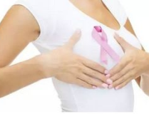 乳腺癌最佳治疗方案,手术、放疗、化疗与内分泌治疗全解析